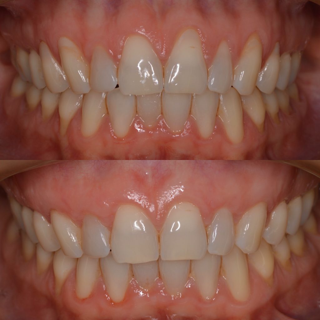 ambrosio odontologia periodontia em sao paulo